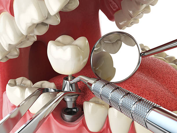 Best Emergency Denture Repair in Soh Jordan, UT